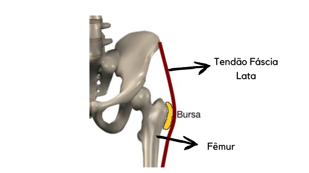 Tratamento de bursite