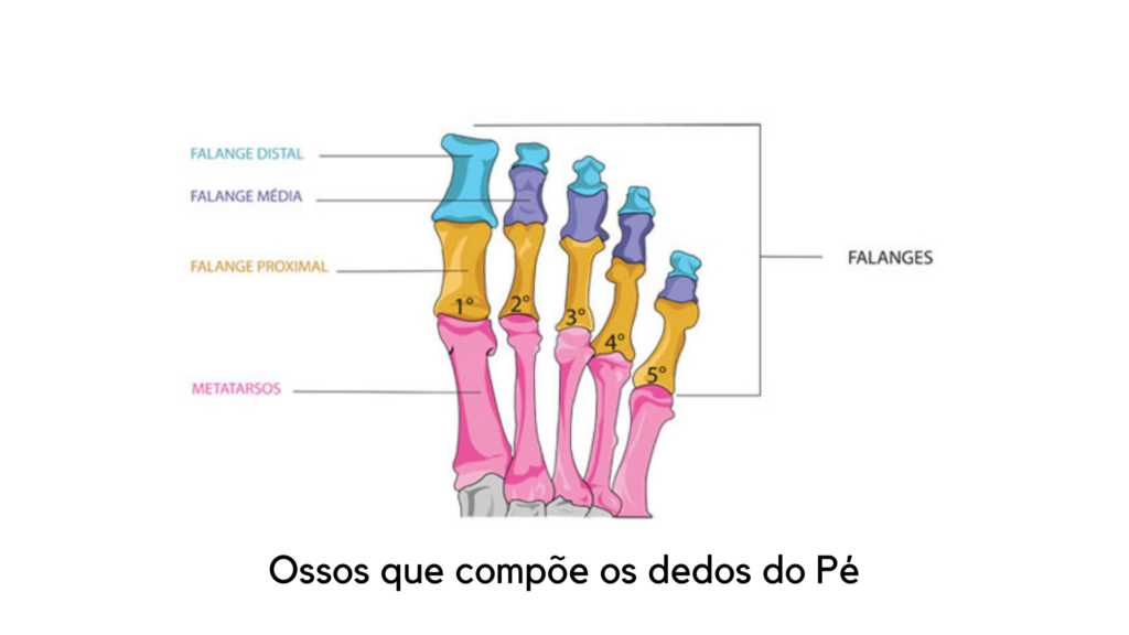 Dedo do pe quebrado