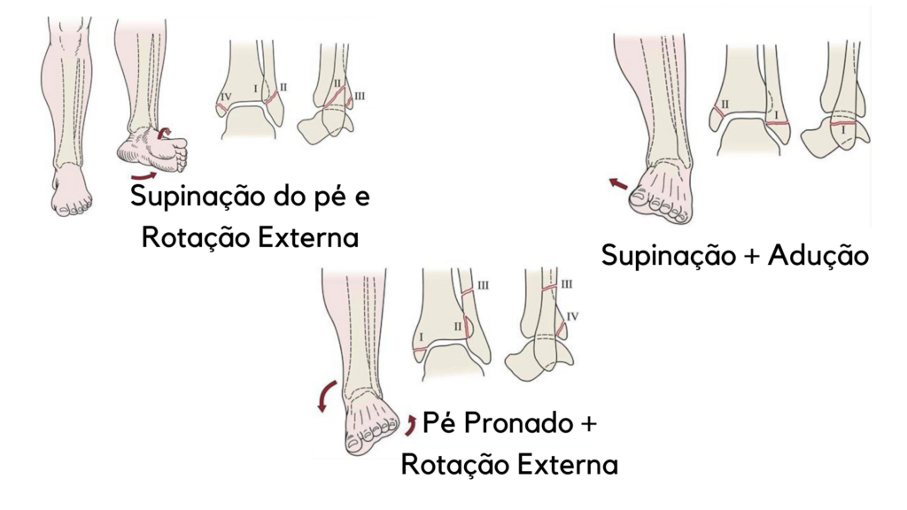 Fraturas do tor