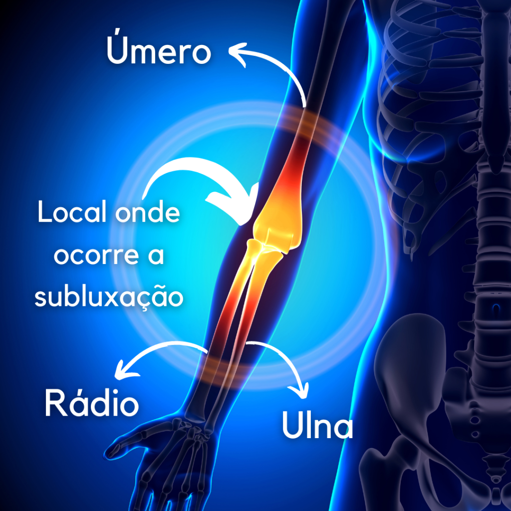 Pronação dolorosa anatomia