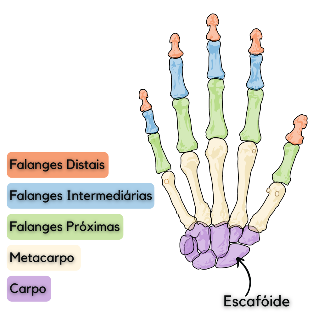 Fratura do Escafóide O que é Medicina Ortopédica