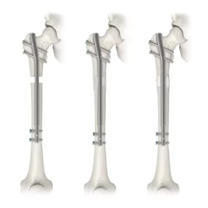 Ellipse_Precice_Banner_Wht_04_MFEdit